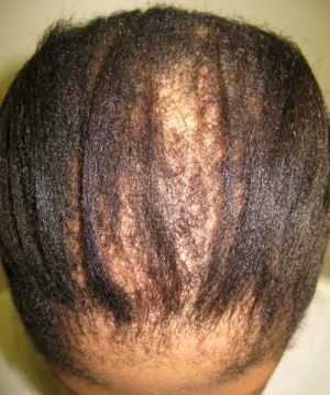 The Top 7 Reasons You’re Losing Hair (and Why It Matters for Your Growth Journey)